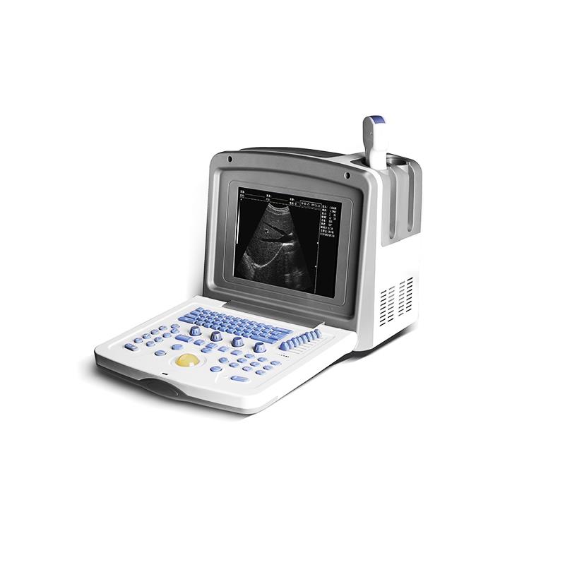 贝尔斯BLS-830便携式超声诊断仪-整机图像清晰、稳定、分辨率高